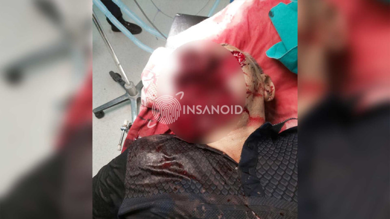 Mingəçevirdə aptek sahibi özünü güllələdi - EKSKLÜZİV FOTO