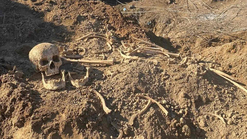 Ağdamda 30 il əvvəl öldürülərək basdırıldığı ehtimal olunan insan sümükləri aşkarlanıb