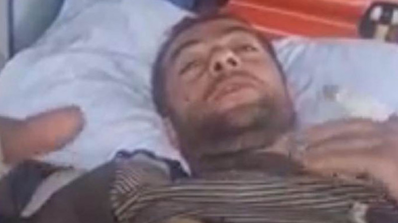 Laçın sakini ayı hücumuna məruz qalıb