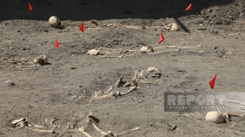 Şuşada kütləvi məzarlıqda tapılan meyit qalıqlarının qarın nahiyəsində mismarlar aşkarlanıb
