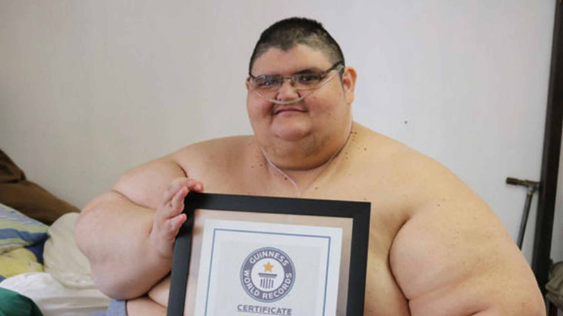 Dünyanın ən kök adamı 330 kiloqram arıqlayıb