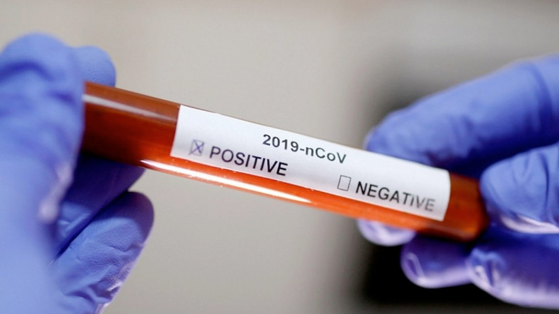 Hazırda Azərbaycanda koronavirusun Eris variantının yayılması barədə rəsmi məlumat yoxdur