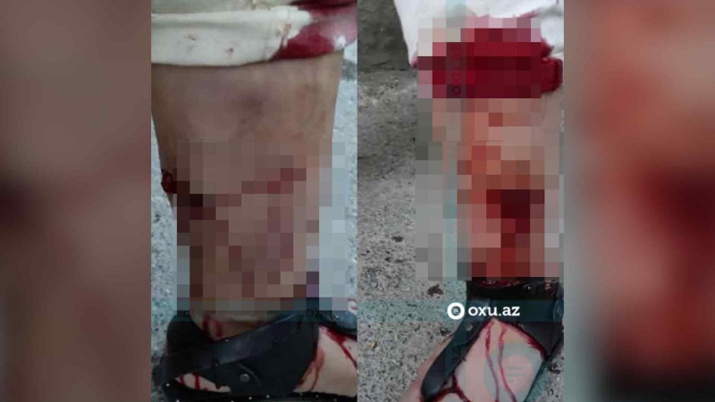 Xırdalanda küçə itlərinin növbəti qurbanı