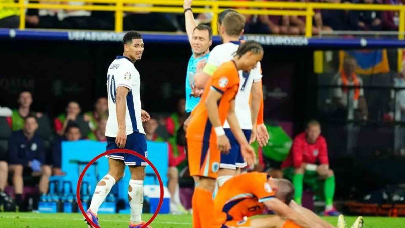 İngiltərə futbolçularının corabları niyə deşik-deşik olur?