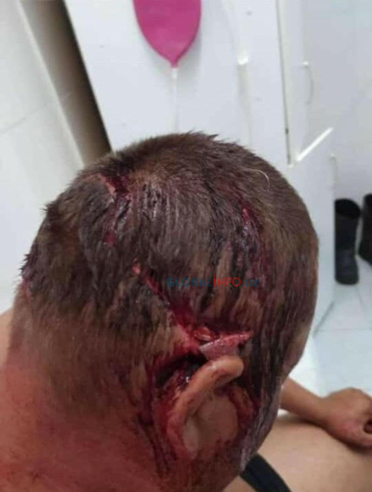 Abxaziya “prezident”i istefa verdi - FOTO