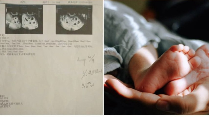 Çində qadın həblə doqquz uşağa hamilə qalıb