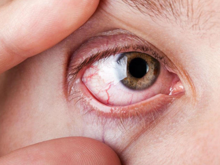 Bu xəstəliklər insanın gözündə əks olunur