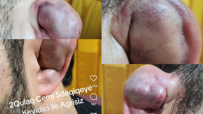 Bakıda qulaq sındırırlar! Özü də pulla – VİDEO