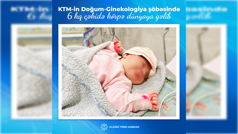 Kliniki Tibbi Mərkəzin Doğum-Ginekologiya şöbəsində 6 kq çəkidə körpə dünyaya gəlib