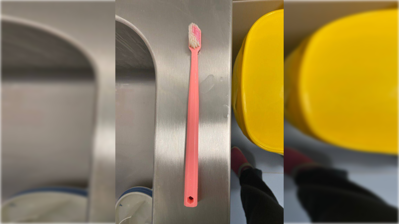 16 yaşlı qızın mədəsindən diş fırçası çıxarılıb