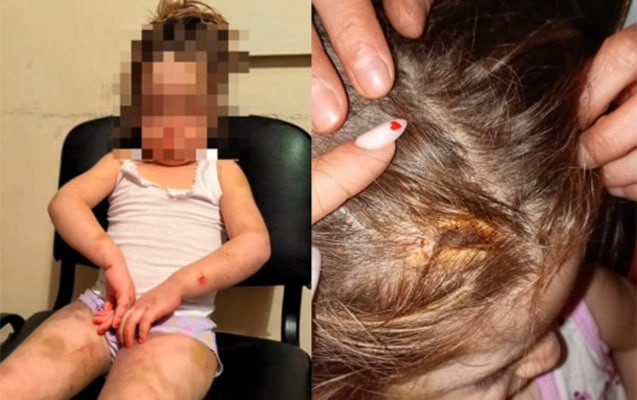 Azyaşlıya zorakılıq göstərən anası saxlanılıb, cinayət işi açılıb