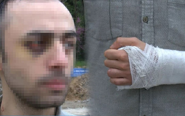 Türkiyədə azərbaycanlı tələbəni döyüb videoya çəkənlərə AĞIR CƏZA