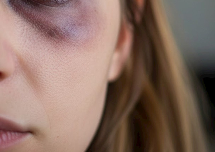 Stuldan yıxılmış arvadını təpiklədi, sümüklərini qırdı — Xaçmazdakı cinayətin detalları