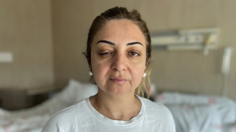 3 qadın botoksdan sonra xəstəxanaya yerləşdirildi: Danışmaqda və görməkdə çətinlik çəkirlər