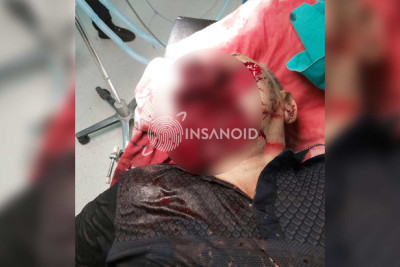 Mingəçevirdə aptek sahibi özünü güllələdi - EKSKLÜZİV FOTO