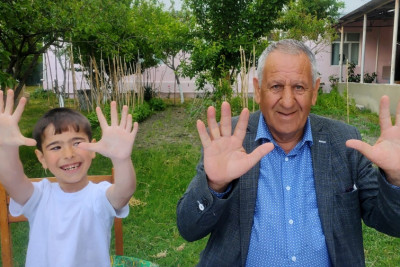 6 barmaqlı uşaq: “Barmaqlarımdan xoşum gəlir, bunlardan heç kimdə yoxdur”