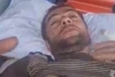 Laçın sakini ayı hücumuna məruz qalıb