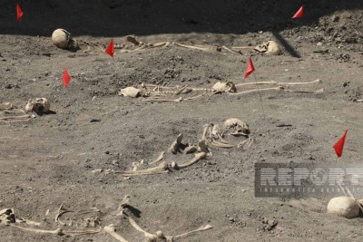 Şuşada kütləvi məzarlıqda tapılan meyit qalıqlarının qarın nahiyəsində mismarlar aşkarlanıb