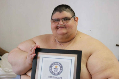 Dünyanın ən kök adamı 330 kiloqram arıqlayıb