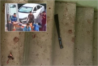 Qızın keçmiş sevgilisi onun gözü qarşısında yenisinin barmaqlarını doğrayıb