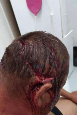 Abxaziya “prezident”i istefa verdi - FOTO