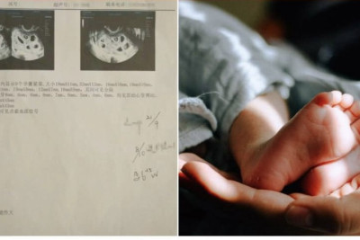 Çində qadın həblə doqquz uşağa hamilə qalıb