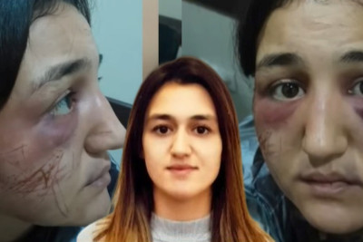 Paytaxtda DƏHŞƏT: 24 yaşlı qadın amansızca döyülüb - VİDEO