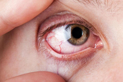 Bu xəstəliklər insanın gözündə əks olunur