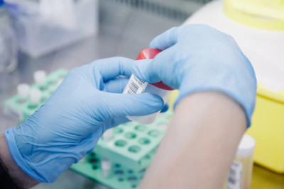 Son zamanlar yayılan viruslardan necə qorunaq? – Terapevtdən AÇIQLAMA