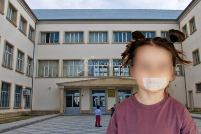Bakı məktəbində ŞOK - Müəllim şagirdlərin ağzını "skoç"ladı
