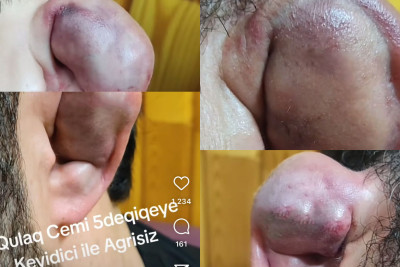 Bakıda qulaq sındırırlar! Özü də pulla – VİDEO