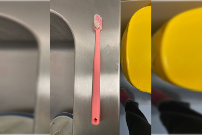 16 yaşlı qızın mədəsindən diş fırçası çıxarılıb