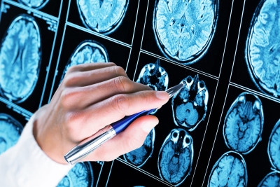 Hansı məhsulların beyin hüceyrələrinin məhvinə səbəb olduğu açıqlandı