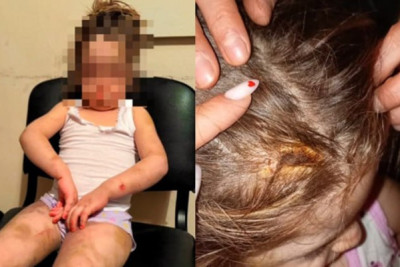 Azyaşlıya zorakılıq göstərən anası saxlanılıb, cinayət işi açılıb