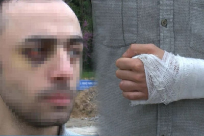 Türkiyədə azərbaycanlı tələbəni döyüb videoya çəkənlərə AĞIR CƏZA