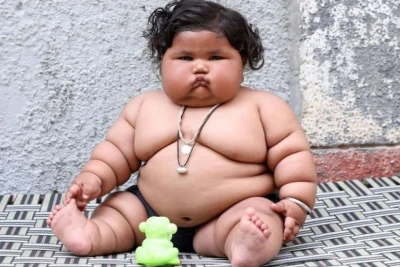 BMT: Dünyada artıq çəkili uşaqların sayı iki dəfə artaraq 391 milyona çatıb