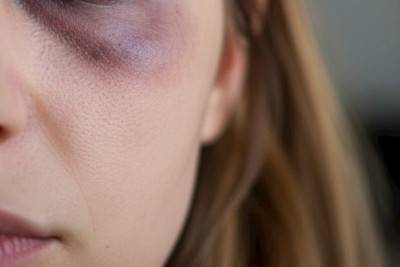 Stuldan yıxılmış arvadını təpiklədi, sümüklərini qırdı — Xaçmazdakı cinayətin detalları